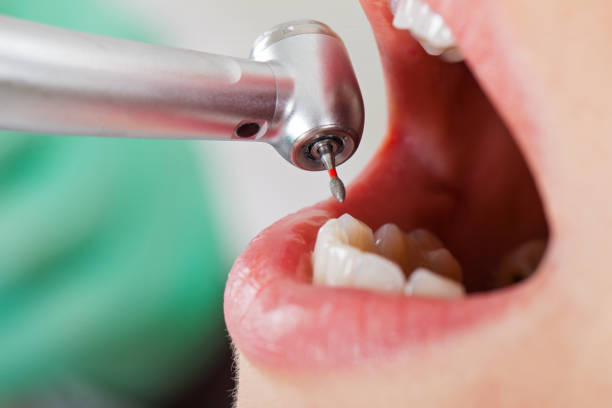 Professional Emergency Dental Service in FL